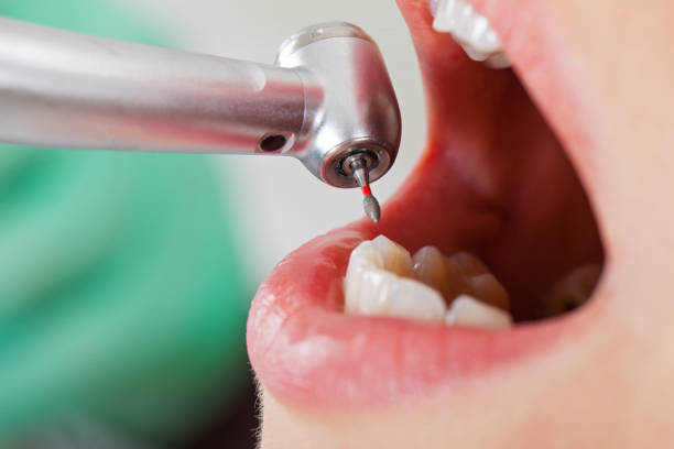 Best Emergency Root Canal Therapy in Cordry Sweetwater Lakes, IN